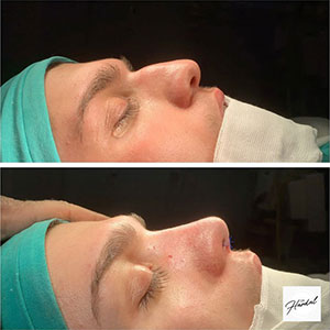 before-after